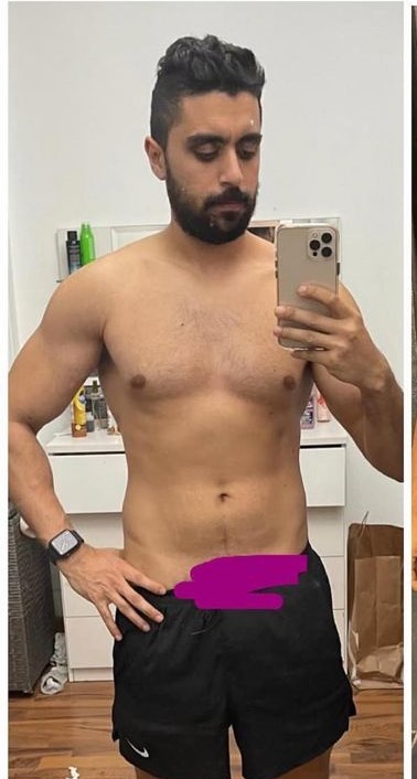 transformation